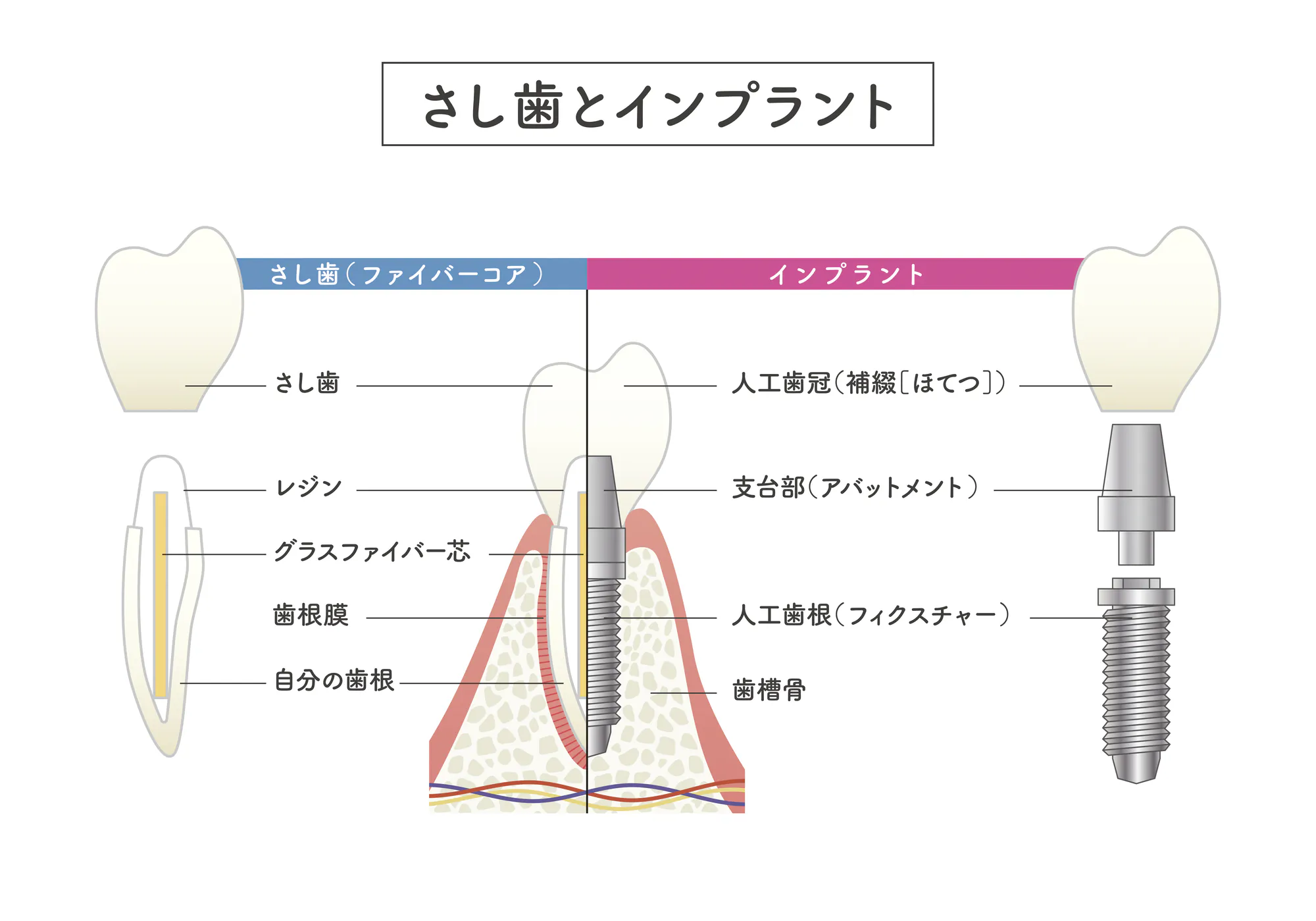 小宮歯科医院｜薬園台（船橋市）の歯医者、小宮歯科医院の自家歯牙移植